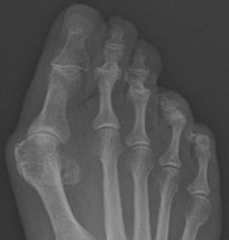 Рентгенограммы ноги